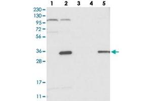 Western blot analysis of Lane 1: RT-4, Lane 2: U-251 MG, Lane 3: Human Plasma, Lane 4: Liver, Lane 5: Tonsil with C14orf94 polyclonal antibody . (C14orf94 Antikörper)