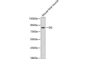 Western blot analysis of extracts of Mouse fetal muscle using SKI Polyclonal Antibody. (SKI Antikörper)