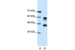 Western Blot showing PSMC5 antibody used at a concentration of 1-2 ug/ml to detect its target protein.