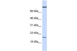 WB Suggested Anti-GABARAP Antibody Titration:  0. (GABARAP Antikörper  (N-Term))
