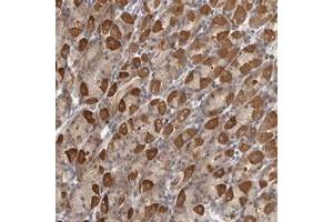Immunohistochemical staining of human stomach with PARP6 polyclonal antibody  shows strong cytoplasmic positivity in Parietal cells at 1:50-1:200 dilution. (PARP6 Antikörper)
