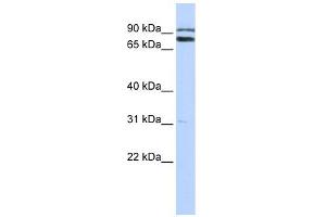TRIM67 antibody used at 1 ug/ml to detect target protein. (TRIM67 Antikörper  (C-Term))