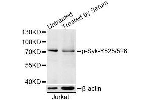 Western blot analysis of extracts of Jurkat cells, using Phospho-Syk-Y525/526 antibody (ABIN5996170) at 1/1000 dilution. (SYK Antikörper  (pTyr525, pTyr526))