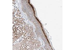 Immunohistochemical staining of human skin with TSR2 polyclonal antibody  shows strong positivity in superficial layers.