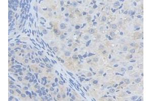 DAB staining on IHC-P; Samples: Mouse Ovary Tissue (ALDH9A1 Antikörper  (AA 322-494))