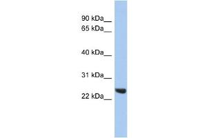 Western Blotting (WB) image for anti-Proteasome (Prosome, Macropain) Subunit, beta Type 2 (PSMB2) (Middle Region) antibody (ABIN2786716)