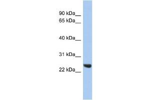 WB Suggested Anti-PSMB2 Antibody Titration: 0. (PSMB2 Antikörper  (Middle Region))