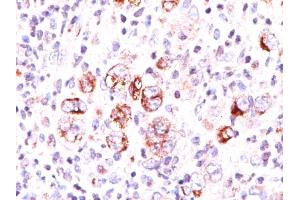 Immunohistochemistry (IHC) image for anti-BCL2-Like 1 (BCL2L1) (AA 3-14) antibody (ABIN6940510)