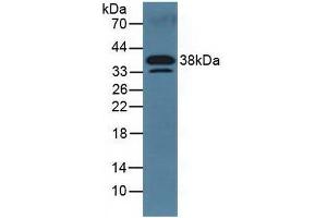Detection of DKK3 in Mouse Serum using Polyclonal Antibody to Dickkopf Related Protein 3 (DKK3) (DKK3 Antikörper  (AA 23-349))