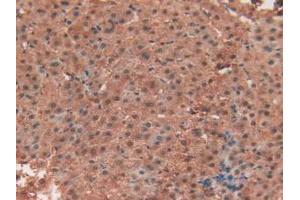 IHC-P analysis of Human Liver Tissue, with DAB staining. (TEK Antikörper  (AA 1-116))