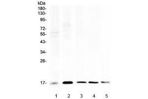 Western blot testing of 1) human placenta, 2) human HeLa, 3) rat spleen, 4) rat RH35 and 5) mouse spleen lysate with Psoriasin antibody at 0. (S100A7 Antikörper)