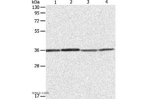 Western blot analysis of Hela, 293T, A431 and Jurkat cell, using RPLP0 Polyclonal Antibody at dilution of 1:600 (RPLP0 Antikörper)