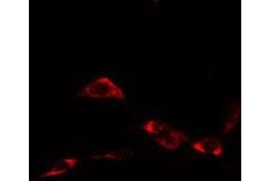 ABIN6276372 staining  NIH-3T3 cells by IF/ICC. (HSP90AA1 Antikörper  (C-Term))