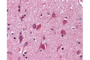 Anti-AGPS antibody IHC of human brain, cortex. (AGPS Antikörper  (AA 370-628))