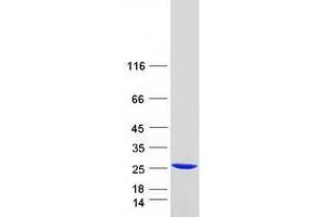 Western Blotting (WB) image for RAB24, Member RAS Oncogene Family (RAB24) (Transcript Variant 1) protein (Myc-DYKDDDDK Tag) (ABIN2730304)