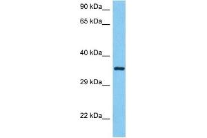 Western Blotting (WB) image for anti-Annexin A5 (ANXA5) (N-Term) antibody (ABIN2774836)