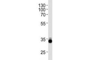 OTX2 antibody western blot analysis in Y79 lysate (OTX2 Antikörper  (AA 261-289))
