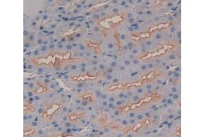 Used in DAB staining on fromalin fixed paraffin- embedded Kidney tissue (Band 3/AE1 Antikörper  (AA 558-675))