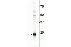 Western blot of rat hippocampal homogenate showing specific immunolabeling of the ~24 kDa UCHL1 protein.