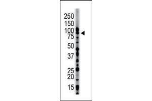 Image no. 1 for anti-Hepatocyte Growth Factor-Regulated tyrosine Kinase Substrate (HGS) (N-Term) antibody (ABIN357582) (HGS Antikörper  (N-Term))