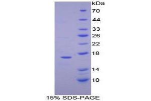 SDS-PAGE (SDS) image for Ribonuclease, RNase A Family, 1 (Pancreatic) (RNASE1) (AA 29-156) protein (His tag) (ABIN1080669) (RNASE1 Protein (AA 29-156) (His tag))