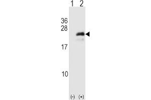 Western Blotting (WB) image for anti-Neurogenin 3 (NEUROG3) antibody (ABIN3001396)