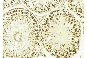 ABIN6269184 at 1/100 staining Mouse testis tissue by IHC-P. (ELK1 Antikörper  (C-Term))