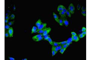 Immunofluorescence (IF) image for anti-IMP (Inosine 5'-Monophosphate) Dehydrogenase 2 (IMPDH2) (AA 5-514) antibody (ABIN7156292)