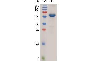 SDS-PAGE (SDS) image for Prolactin Receptor (PRLR) (AA 25-234) protein (Fc Tag) (ABIN7490927)