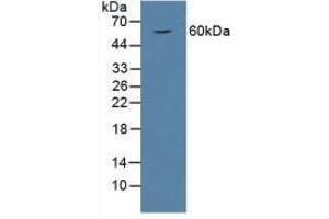Detection of HPSE in Rat Serum using Polyclonal Antibody to Heparanase (HPSE) (HPSE Antikörper  (AA 40-188))