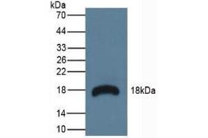 Detection of RNASE3 in Mouse Lymphonodus Tissue using Polyclonal Antibody to Ribonuclease A3 (RNASE3) (RNASE3 Antikörper  (AA 34-150))