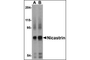 Western blot analysis of Nicastrin in human brain tissue lysate with this product at (A) 0. (Nicastrin Antikörper  (Center))