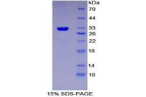 SDS-PAGE (SDS) image for ATP-Binding Cassette, Sub-Family C (CFTR/MRP), Member 1 (ABCC1) (AA 1219-1469) protein (His tag) (ABIN2125975)