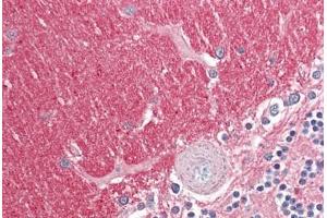Image no. 2 for anti-Guanine Nucleotide Binding Protein (G Protein), beta Polypeptide 3 (GNB3) (AA 309-321) antibody (ABIN1496050) (GNB3 Antikörper  (AA 309-321))