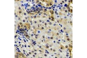 Immunohistochemical analysis of B9D1 staining in rat kidney formalin fixed paraffin embedded tissue section.