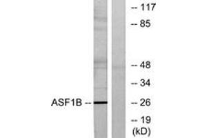 Western blot analysis of extracts from K562 cells, using ASF1B Antibody. (ASF1B Antikörper  (AA 101-150))