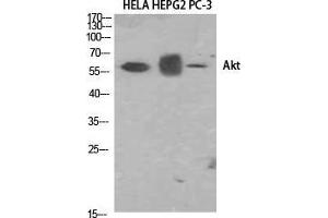 Western Blot (WB) analysis of HELA, HepG2, PC-3 using Akt1 Polyclonal Antibody. (AKT1 Antikörper  (N-Term))