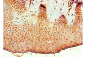 Immunohistochemistry of paraffin-embedded human skin tissue using ABIN7145683 at dilution of 1:100 (BMP15 Antikörper  (AA 143-392))