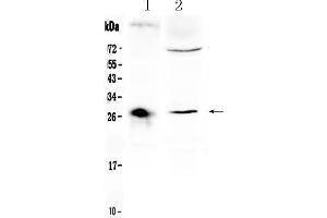 Western blot analysis of CD151 using anti- CD151 antibody . (CD151 Antikörper  (AA 113-175))