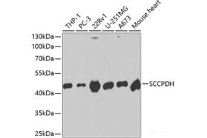 Western blot analysis of extracts of various cell lines using SCCPDH Polyclonal Antibody at dilution of 1:1000. (SCCPDH Antikörper)
