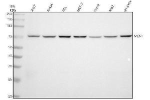 Western blot analysis of Menin using anti-Menin antibody (ABIN7605542).