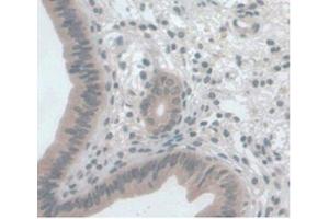 DAB staining on IHC-P Samples:Mouse Uterus Tissue) (CCL2 Antikörper  (AA 24-96))