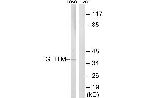 Western blot analysis of extracts from LOVO cells, using GHITM antibody. (GHITM Antikörper  (Internal Region))