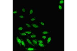 Immunofluorescent analysis of A549 cells using ABIN7162833 at dilution of 1:100 and Alexa Fluor 488-congugated AffiniPure Goat Anti-Rabbit IgG(H+L) (FKBP3 Antikörper  (AA 2-224))