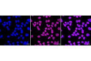 Immunocytochemical staining of HeLa cells with C-terminal binding protein 2 antibody (ABIN7797816), 1:1,000). (Rekombinanter CTBP2 Antikörper)
