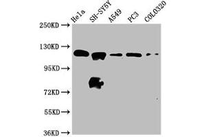 Western Blot Positive WB detected in: Hela whole cell lysate, SH-SY5Y whole cell lysate, A549 whole cell lysate, PC-3 whole cell lysate, COLO320 whole cell lysate All lanes: MAML2 antibody at 2. (MAML2 Antikörper  (AA 347-506))