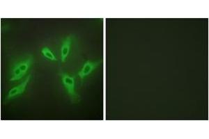 Immunofluorescence analysis of HeLa cells, using TUSC3 Antibody. (TUSC3 Antikörper  (AA 131-180))