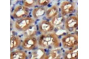 Used in DAB staining on fromalin fixed paraffin-embedded Kidney tissue