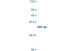 MTPN Protein (AA 1-118) (GST tag)