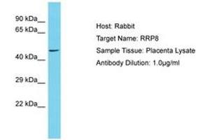 Image no. 1 for anti-Ribosomal RNA Processing 8 (RRP8) (AA 100-149) antibody (ABIN6750590)